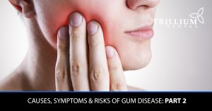 reasons-to-consider-smile-in-a-day-dental-implants 2